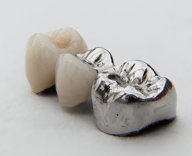 Bruecke dental